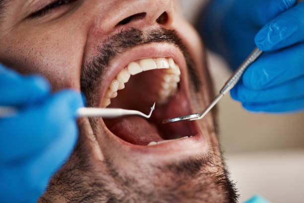 Laser Dentistry in Pleasant Run, OH